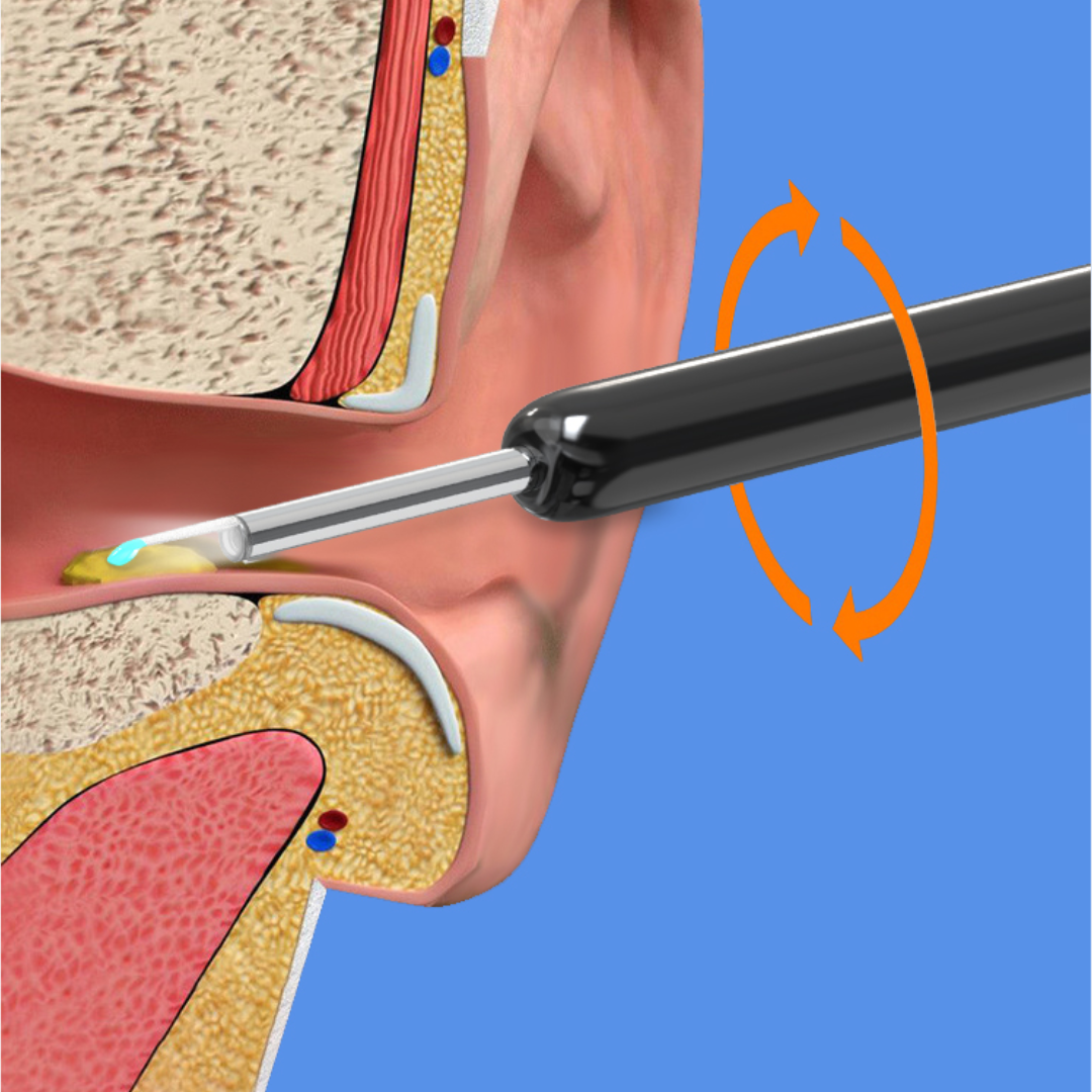 iScope™ Pro Max (+ 1 FREE Utensils Kit)